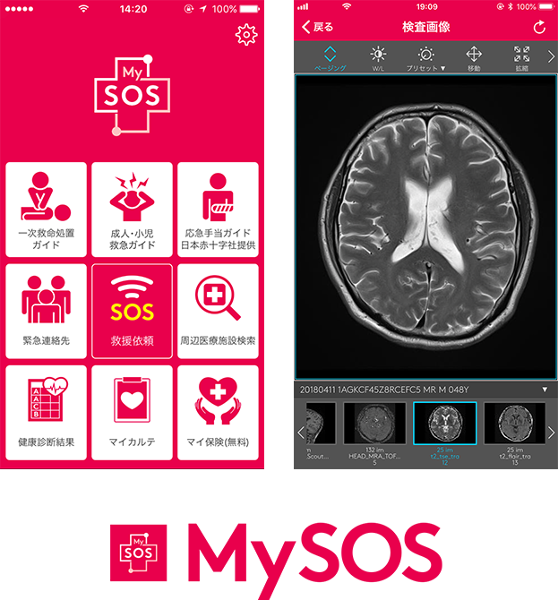 mysos